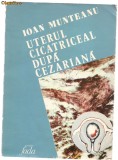 *1B(10) Ion Muntean-UTERUL CICATRICEAL DUPA OPERATIE