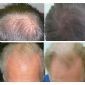Vand Velform Hair Grow Plus foto