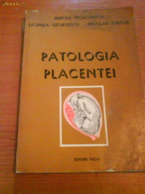 720Mircea Georgescu,Nicoleta Tudose-Patologia placentei foto