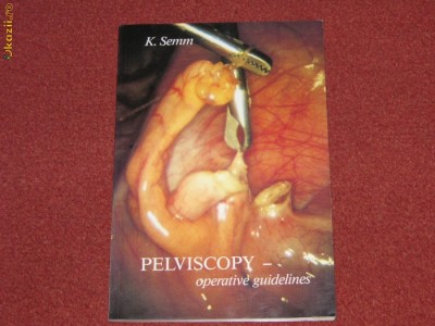 Pelviscopy - operativ guidelines - K. Semm foto