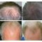 Vand Velform Hair Grow Plus