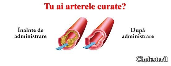 Tratament colesterol si trigliceride drojdie de orez rosu