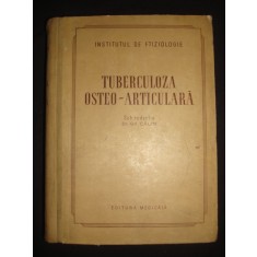 Gh. Calin - Tuberculoza osteo-articulara (1956, editie cartonata)
