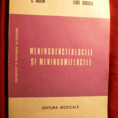 C. Arseni si L Horvath - Meningoencefalocele - ed. 1984