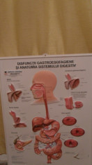 Planse Disfunctii Gastroesofagiene si Anatomia Sistemului Digestiv foto