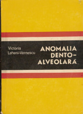 Anomalia dento-alveolara - Victoria Leheni-Vernescu foto