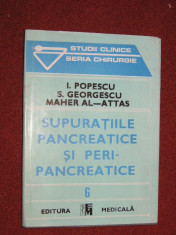 SUPURATIILE PANCREATICE SI PERIPANCREATICEI - Popescu, S. Georgescu, Maher Al-Attas foto