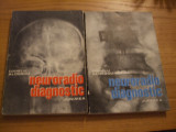 NEURORADIO DIAGNOSTIC - Practic * Vol. I + II - Corneliu Aldescu - 1982, 1987, Alta editura
