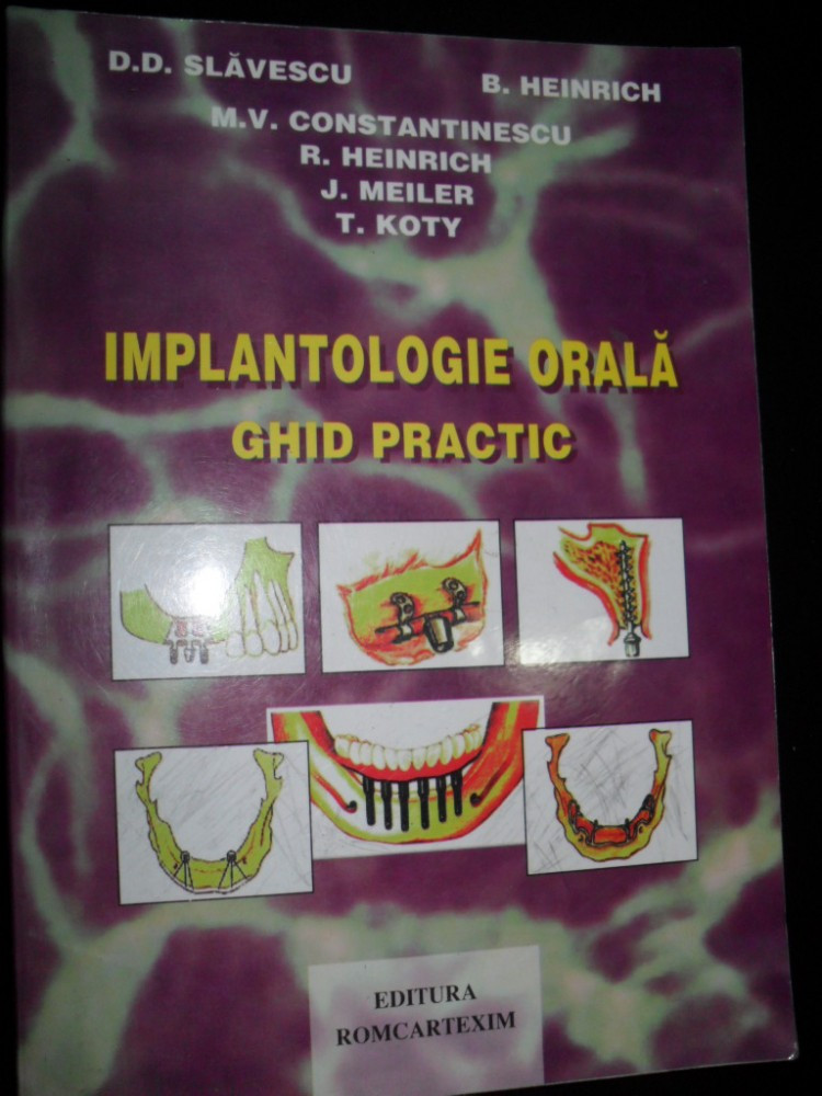 Implantologie Orala/ghid Practic-D.Slavescu,B.Heinrich | Arhiva Okazii.ro