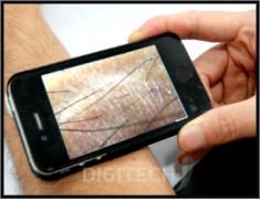 Video-dermatoscop pentru Smartphones foto