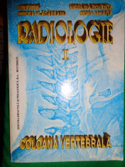 Radiologie/ coloana vertebrala-Ion Pana,Nicolina Roventa,Indra Mihaita,Mircea Vladareanu foto