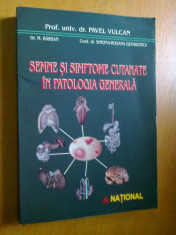 SEMNE SI SIMPTOME CUTANATE IN PATOLOGIA GENERALA - PAVEL VULCAN, M. BARSAN, SIMONA-ROXANA GEORGESCU foto