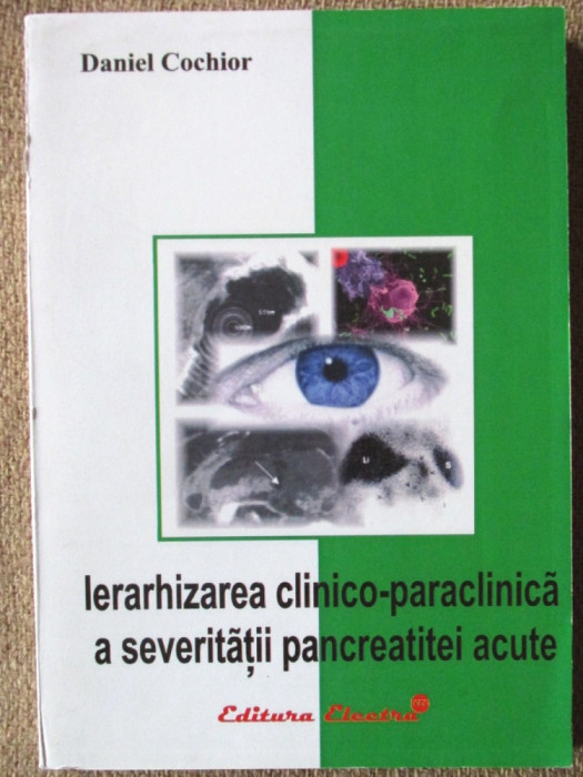 IERARHIZAREA CLINICO-PARACLINICA A SEVERITATII PANCREATITEI ACUTE, D. Cochior