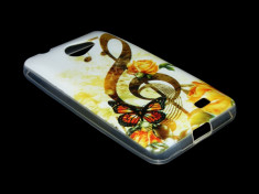 HUSA ALLVIEW A4 YOU / A4 YOU LIFE SILICON MODEL 10 SUN MUSIC - CURIER GRATUIT foto
