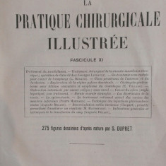 LA PRATIQUE CHIRURGICALE ILLUSTREE - Victor Pauchet (Fasc. XI)
