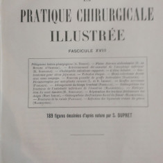 LA PRATIQUE CHIRURGICALE ILLUSTREE - Victor Pauchet (Fasc. XVIII)