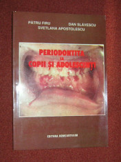 Periodontita la copii si adolescenti - Patru Firu, Dan Savulescu foto