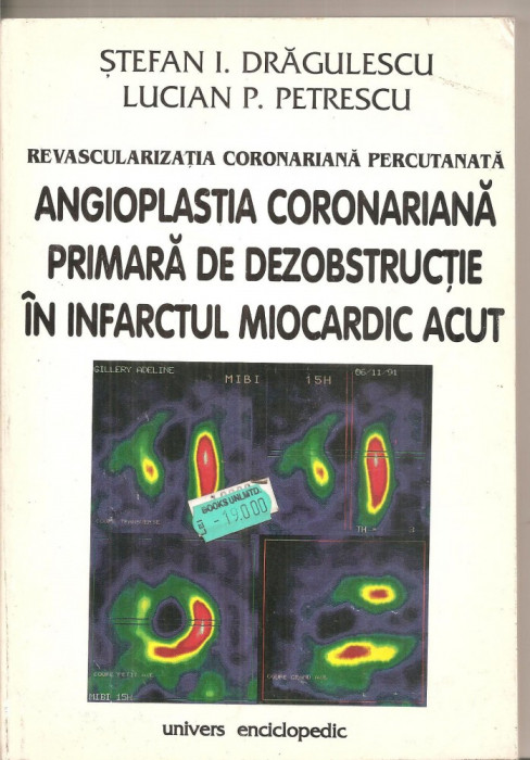 (C6173) ANGIOPLASTIA CORONARIANA PRIMARA DE DEZOBSTRUCTIE IN INFARCTUL MIOCARDIC