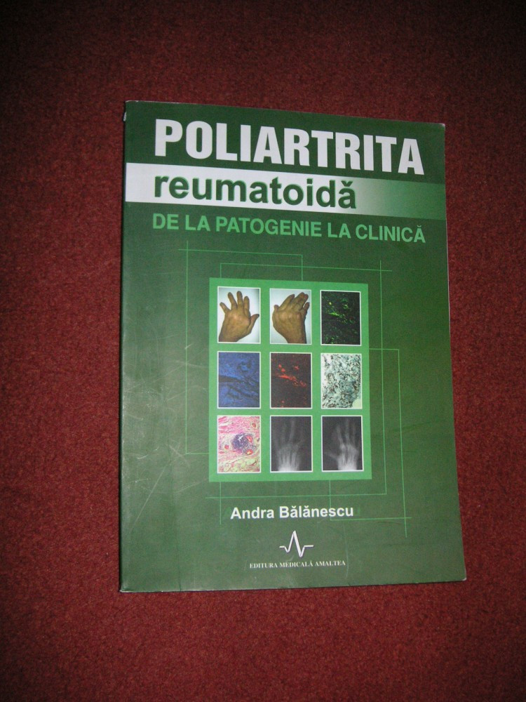 Poliartrita reumatoida de la patologie la clinica - Andra Balanescu |  arhiva Okazii.ro