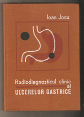 Ioan Jocu-Radiodiagnosticul clinic al ulcerelor gastrice foto