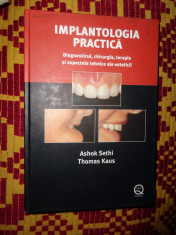 Implantologia practica(diagnosticul,chirurgia,terapia )-A. Setki/Th. Kaus foto