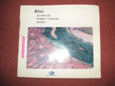 Atlas de infectii fungice cutanate umane (Pfizer) foto