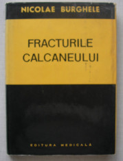 Nicolae Burghele - Fracturile Calcaneului ( hartie cretata - lucioasa ) foto
