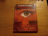 EYELID TUMORS - Clinical Diagnosis and Surgical Treatment - Jay Justin Older, Alta editura