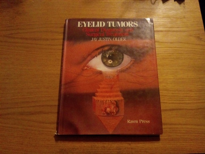 EYELID TUMORS - Clinical Diagnosis and Surgical Treatment - Jay Justin Older