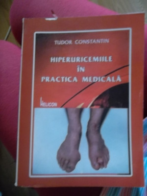 HIPERURICEMIILE IN PRACTICA MEDICALA foto