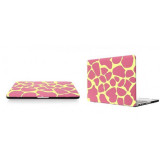 Husa protectie Macbook Retina 13.3 Pink Spot