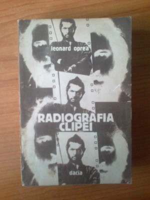 j RADIOGRAFIA CLIPEI - Leonard Oprea foto
