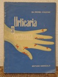 URTICARIA SI ECZEMA -DR.PAVEL VULCAN