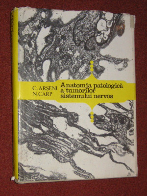 Anatomia Patologica A Tumorilor Sistemului Nervos - C. Arseni, N. Carp foto