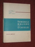 Tumorile maligne ale ochiului - Miron S. Miron, Eliza Climescu