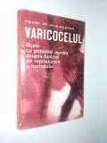 Varicocelul - Boala cu potential agresiv asupra functiei de rep. a barbatului