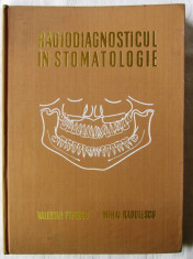 &amp;quot;RADIODIAGNOSTICUL IN STOMATOLOGIE&amp;quot;, Valerian Popescu /Mihai Radulescu, 1973 foto