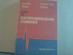 Corneliu Zeana, Gabriel Tatu Chitoiu - CAIET DE ELECTROCARDIOGRAME COMENTATE foto