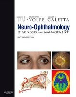 Neuro-Ophthalmology: Diagnosis and Management [With DVD ROM] foto