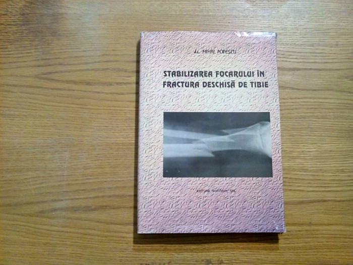 STABILIZAREA FOCARULUI IN FRACTURA DESCHISA DE TIBIE - Mihai Popescu - 1997
