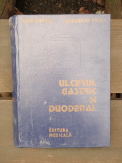 ULCERUL GASTRIC SI DUODENAL - IOAN PUSCAS foto