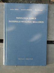 RADIOLOGIA CLINICA A DUODENULUI PATOLOGIC NEULCEROS - I. BIRZU foto