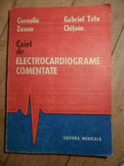 Electrocardiograme Comentate - Corneliu Zeana Gabriel Tatu Chitoiu ,530409 foto