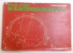 ATLAS CLINIC DE ELECTROENCEFALOGRAFIE de C. ARSENI si IGNAT ROMAN , 1986 foto