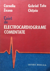 CAIET DE ELECTROCARDIOGRAME COMENTATE - C. Zeana, G. Tatu Chitoiu foto