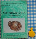 Nefroblastomul Corneliu Sabetay Bogdan Zaharia