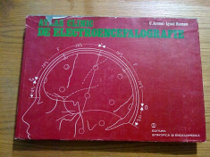 ATLAS CLINIC DE ELECTROENCEFALOGRAFIE - C. Arseni, Ignat Roman - 1986, 371 p. foto