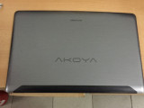 Capac display Medion Akoya P7816 - A131, Acer