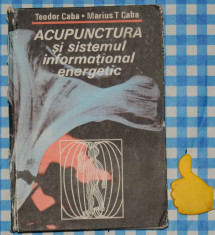 Acupunctura foto