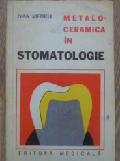 Metaloceramica In Stomatologie - Ivan Viforel ,383389 foto